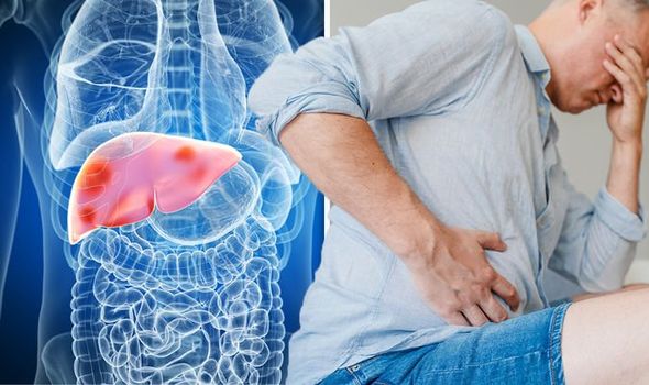 Warning signs and symptoms of liver damage that should not be ignored.